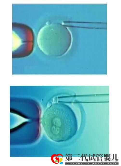 好运健康三代试管知男女的必经之路—胚胎活检术(图3)