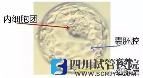 试管婴儿选取移植胚胎的标准是什么(图3)